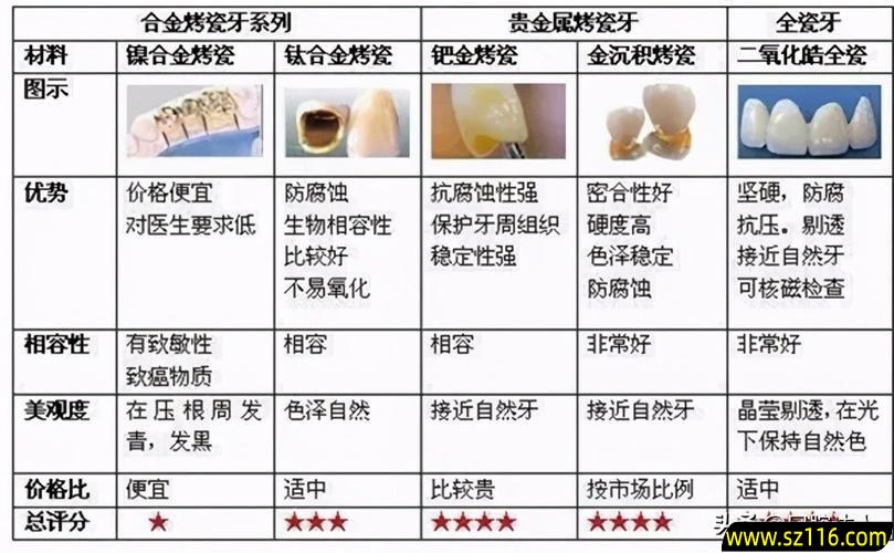 钛合金烤瓷牙金华价格 钛合金烤瓷牙的费用为多少