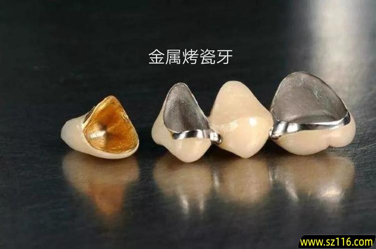 光固化修补烤瓷牙，:烤瓷牙上的瓷掉了可以补瓷吗